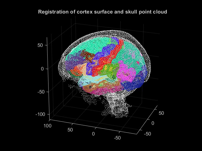 Medical image-based registration project visualization 1