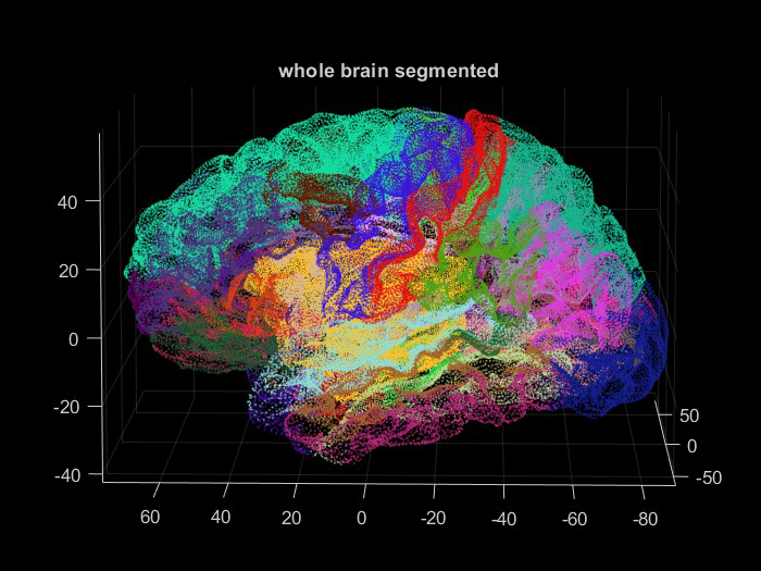 Medical image-based registration project visualization 2
